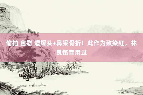 偷拍 自慰 遭爆头+鼻梁骨折!此作为致染红,林良铭曾用过